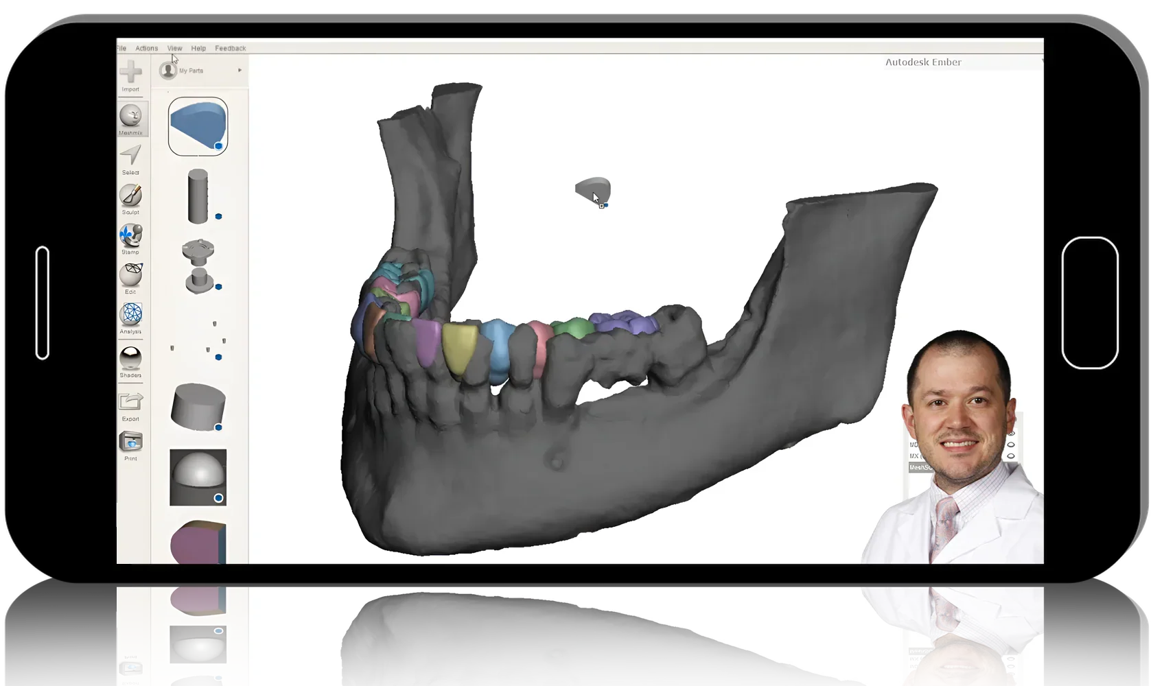 Advanced Implant Planning