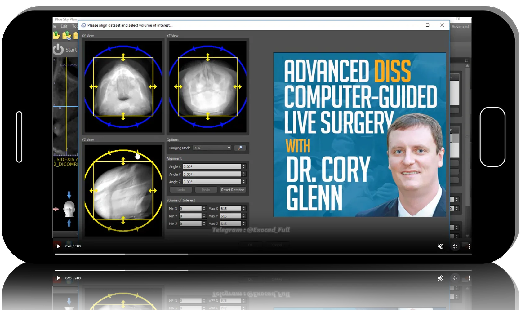 Advanced Guided Surgery: Digital Package