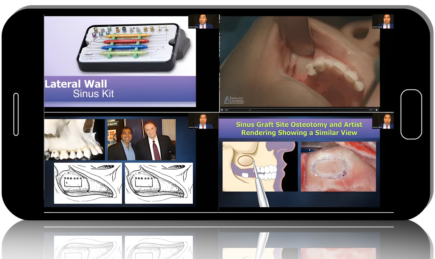 Dental Implants MasterClass: Tipton Training
