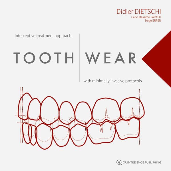 https://cdn.shopify.com/s/files/1/0735/1916/9749/files/41xf4COnZlL.jpg?v=1759192558