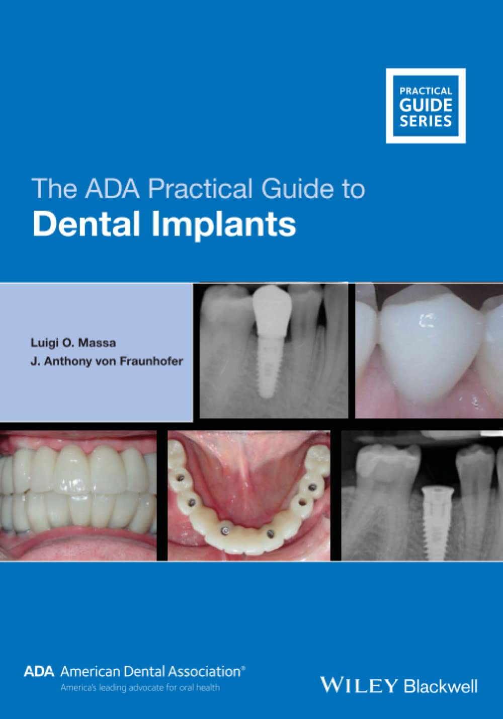 The ADA Practical Guide to Dental Implants, 1st Edition