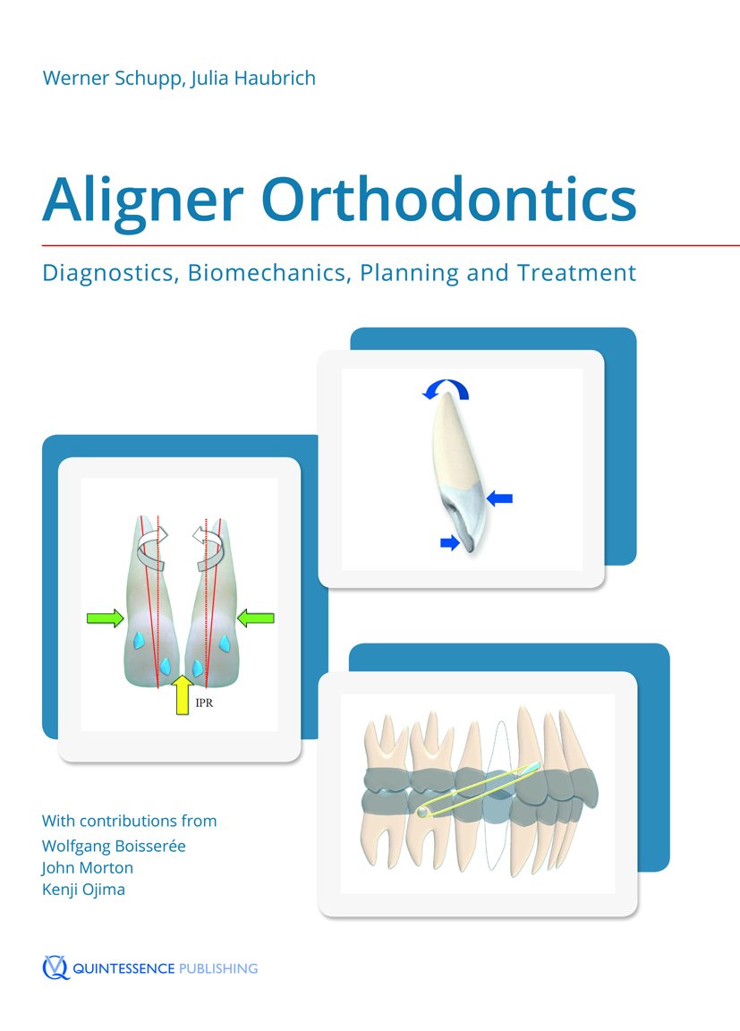 Aligner Orthodontics: Diagnostics, Biomechanics, Planning, and Treatment