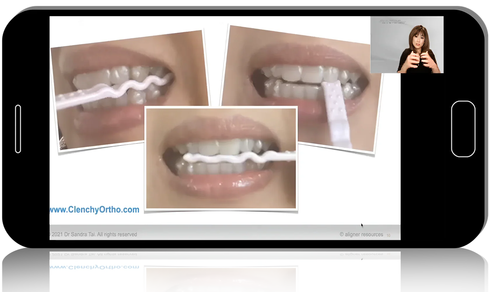 Online clear aligner training from a leading global expert