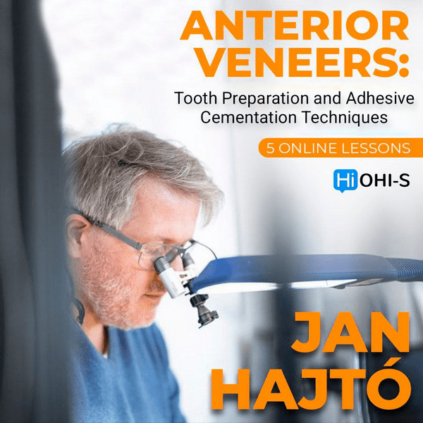 Anterior Veneer: Tooth Preparation and Adhesive Cementation Techniques - Dentistry eBooks
