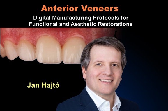 Anterior Veneers: Digital Manufacturing Protocols for Functional and Aesthetic Restorations - Dentistry eBooks