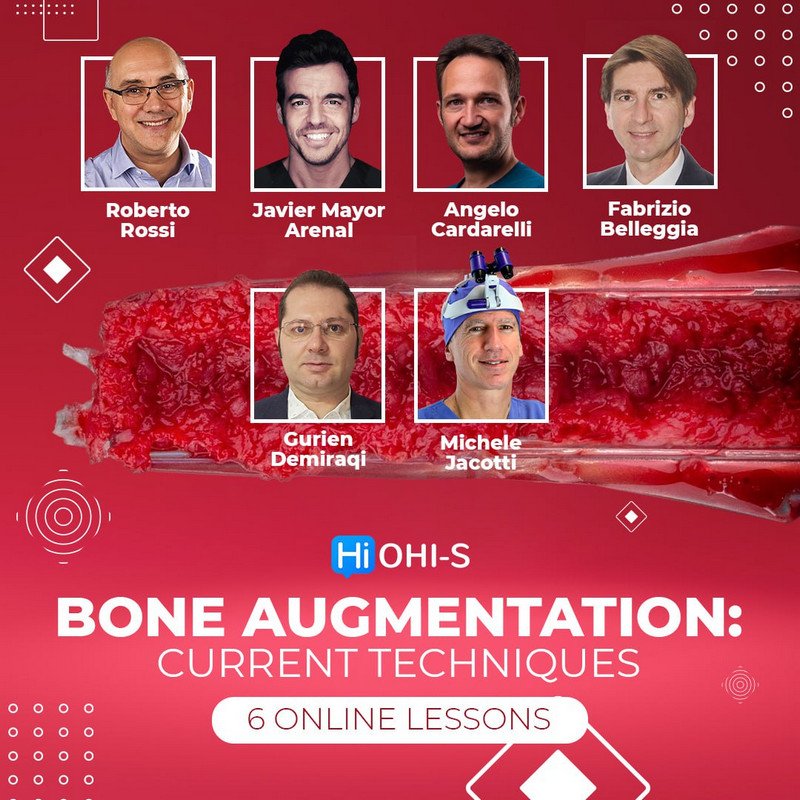 Bone Augmentation: Current Techniques - Dentistry eBooks