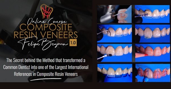 Composite Resin Veneers Course - Dentistry eBooks