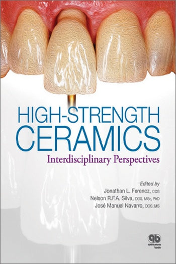 https://dentalmp4.com/wp-content/uploads/2021/03/High-Strength-Ceramics-Interdisciplinary-Perspectives.jpg