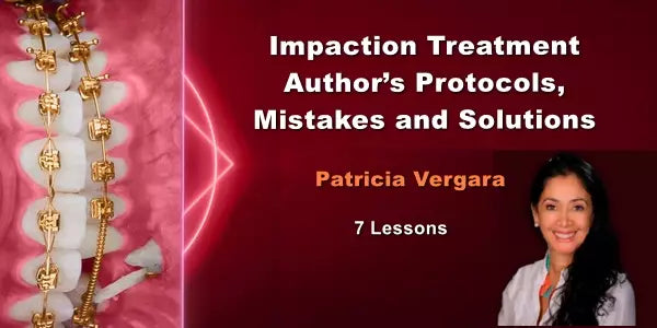 Impaction Treatment Author’s Protocols, Mistakes and Solutions - Dentistry eBooks