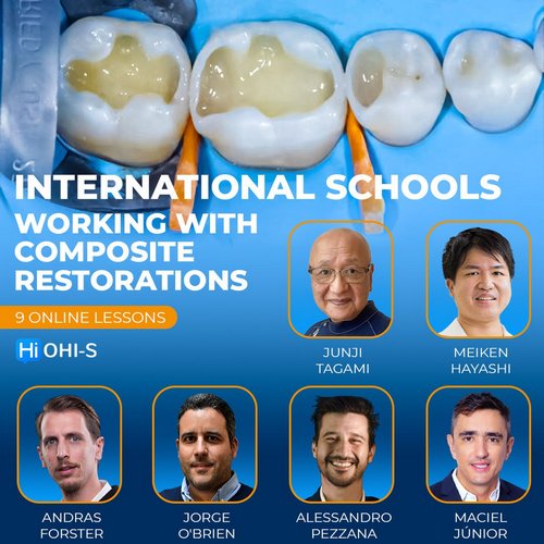 International Schools Working With Composite Restorations - Dentistry eBooks