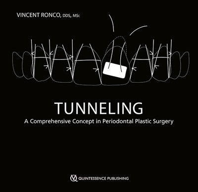 https://dental-books.com/wp-content/uploads/2025/02/Tunneling-A-Comprehensive-Concept-in-Periodontal-Plastic-Surgery.jpg