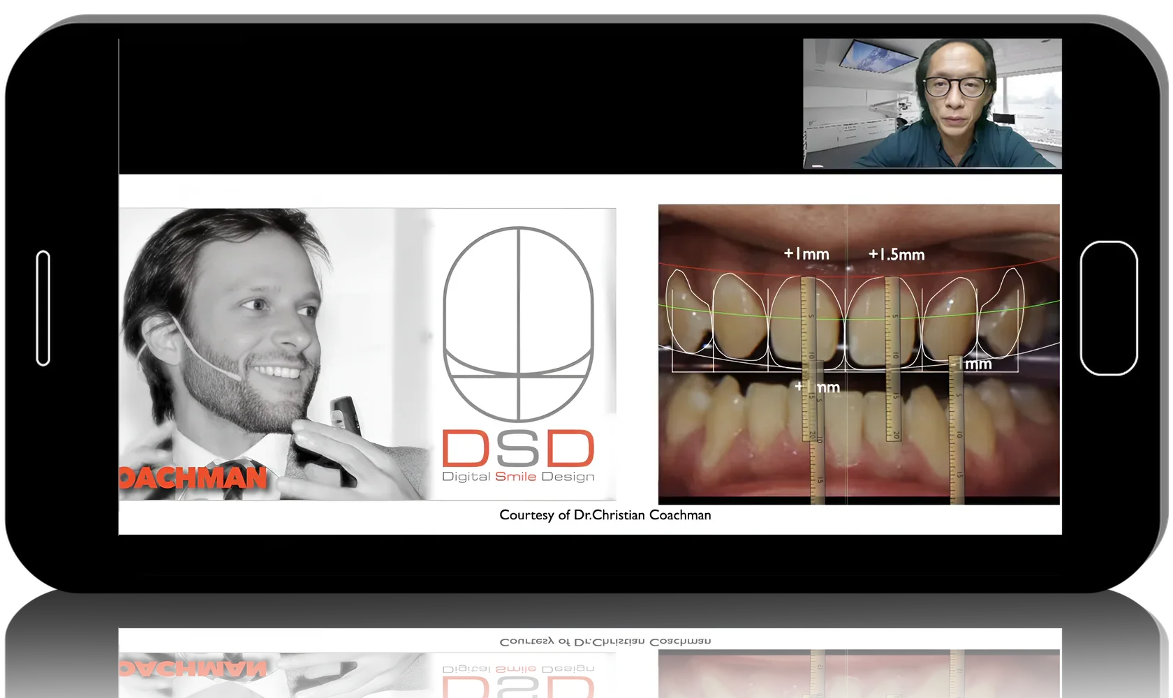 Digital Aesthetic Functional Rehabilitation: Prosthetics, Implantation, Orthodontics
