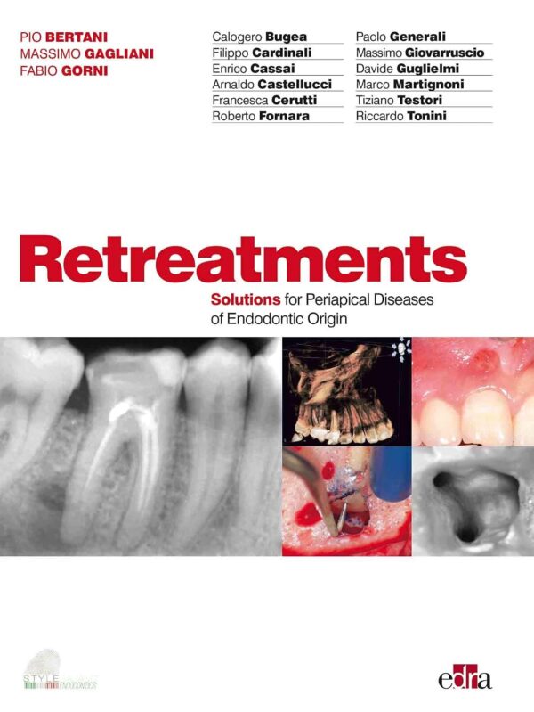 Master Endodontic Retreatment: Comprehensive eBook & Video Course