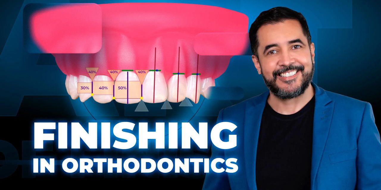 Finishing in orthodontics: aesthetics in the details