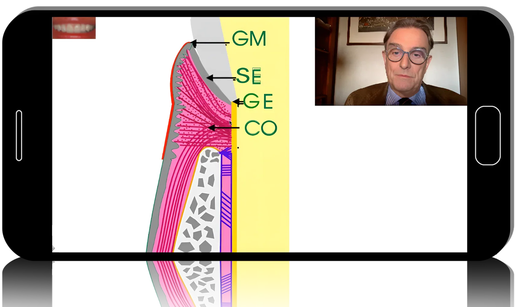 Surgical periodontics: preparation for prosthetics