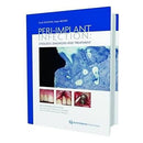 Peri-implant Infection: Etiology, Diagnosis and Treatment