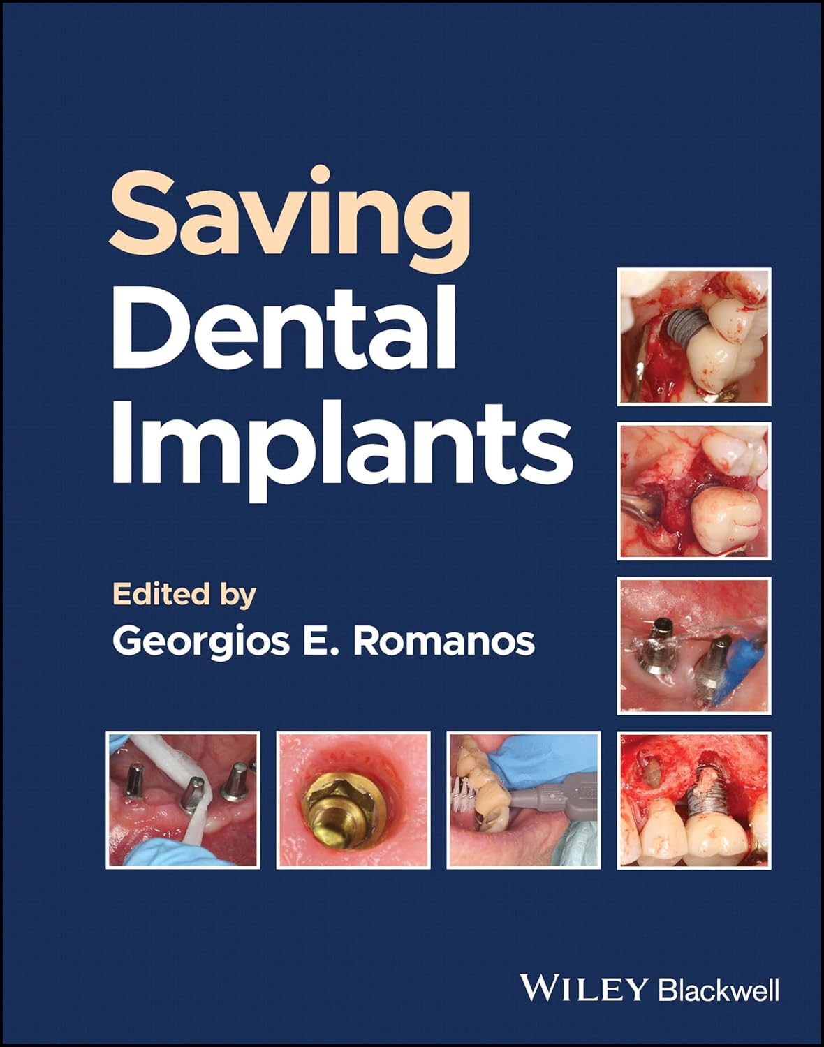 Saving Dental Implants, 1st Edition