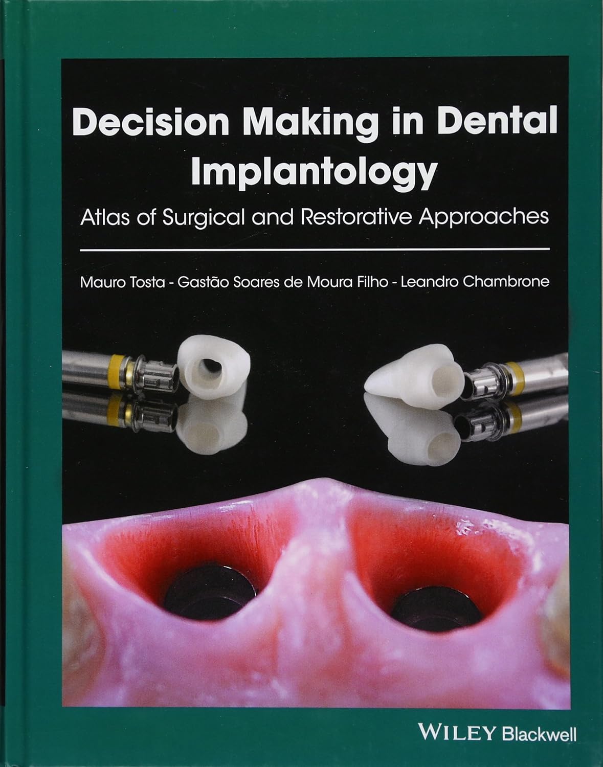Decision Making in Dental Implantology: Atlas of Surgical and Restorative Approaches, 1st Edition