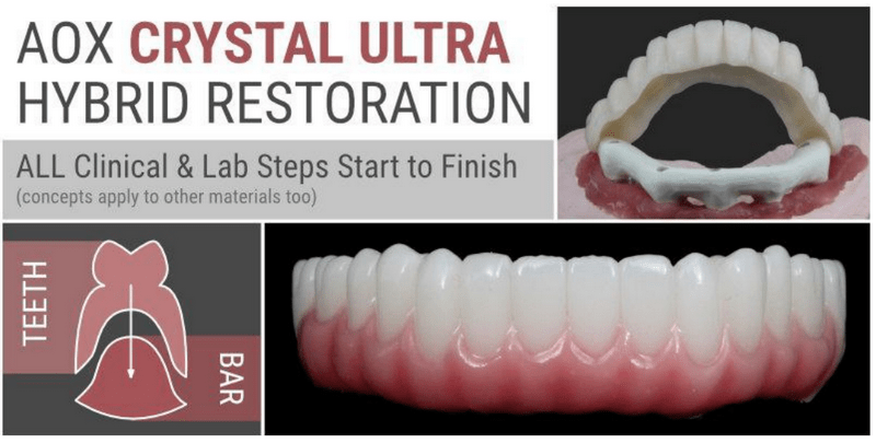 AOX Crystal Ultra Hybrid Restoration - ALL Clinical &amp; Lab Steps Start to Finish - Dentistry eBooks
