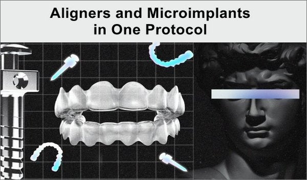 Aligners and Microimplants in One Protocol - Dentistry eBooks