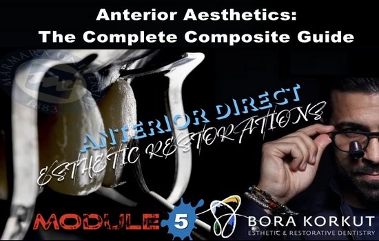 Anterior Aesthetics: The Complete Composite Guide - Dentistry eBooks