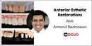 https://dentalmp4.com/wp-content/uploads/2024/05/Anterior-Implant-Esthetic-Restorations.jpg