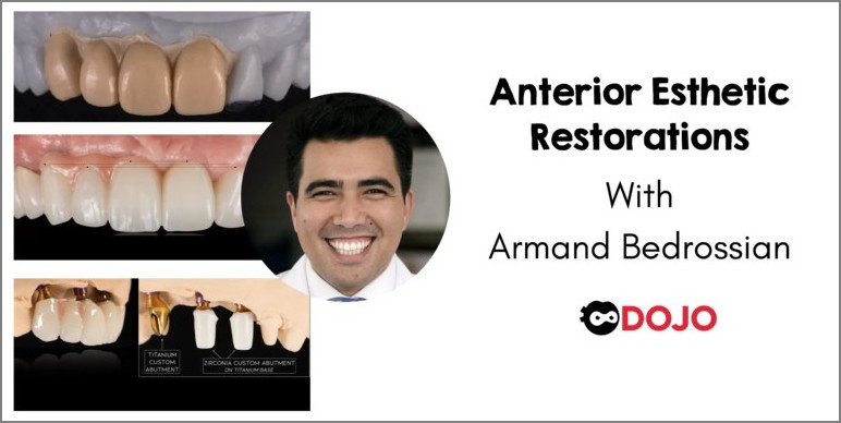 Anterior Implant Esthetic Restorations - Dentistry eBooks