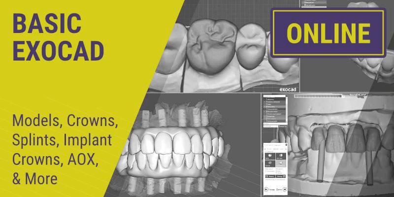 BASIC EXOCAD: Models, Crowns, Splints, Implant Crowns, AOX, &amp; More - Dentistry eBooks