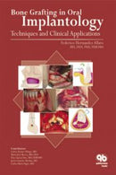 https://www.dentalbooks.org/wp-content/uploads/2019/05/Bone-Grafting-in-Oral-Implantology-Techniques-and-Clinical-Applications-180x270.jpg