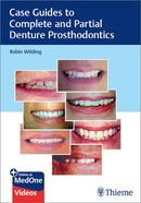 https://dentalmp4.com/wp-content/uploads/2024/04/Case-Guides-to-Complete-and-Partial-Denture-Prosthodontics.webp