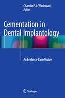 https://dental-library.net/wp-content/uploads/2019/02/Cementation-in-Dental-Implantology.jpg