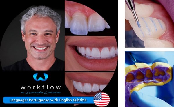 Ceramic Veneers Workflow - Dentistry eBooks