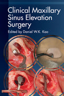 https://www.dentalbooks.org/wp-content/uploads/2019/02/Clinical-Maxillary-Sinus-Elevation-Surgery.jpg