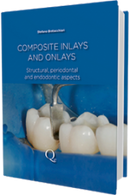 https://www.dentalbooks.org/wp-content/uploads/2020/09/Composite-Inlays-and-Onlays-180x270.png