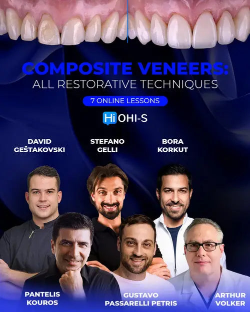 Composite Veneers: All Restorative Techniques - Dentistry eBooks