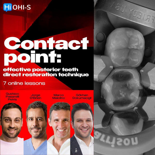 Contact Point: Effective Posterior Teeth Direct Restoration Technique - Dentistry eBooks