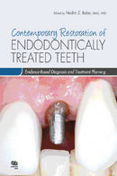 https://www.dentalbooks.org/wp-content/uploads/2019/02/Contemporary-Restoration-of-Endodontically-Treated-Teeth.jpg