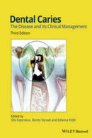 https://www.dentalbooks.org/wp-content/uploads/2019/03/Dental-Caries-The-Disease-and-Its-Clinical-Management-3rd-Edition-180x270.jpg