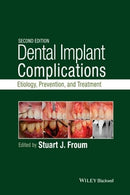 https://www.dentalbooks.org/wp-content/uploads/2019/02/Dental-Implant-Complications-Etiology-Prevention-and-Treatment-2nd-edition.jpg