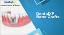 https://dental-books.com/wp-content/uploads/2023/07/DentalXP-Bone-Grafts.jpg