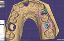 https://dental-books.com/wp-content/uploads/2023/03/Digital-Design-in-Exocad-3.jpg