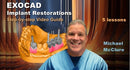 https://dentalmp4.com/wp-content/uploads/2023/08/EXOCAD-Implant-Restorations.jpg