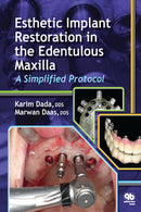 https://www.dentalbooks.org/wp-content/uploads/2019/02/Esthetic-Implant-Restoration-in-the-Edentulous-Maxilla-A-Simplified-Protocol.jpg