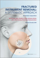 https://dentalmp4.com/wp-content/uploads/2024/07/Fractured-Instrument-Removal_A-Systematic-Approach.jpg