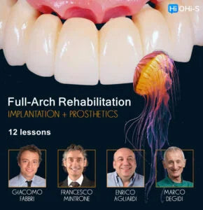 Full-Arch Rehabilitation: Implantation and Prosthetics - Dentistry eBooks
