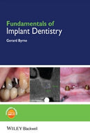 https://www.dentalbooks.org/wp-content/uploads/2019/02/Fundamentals-of-Implant-Dentistry.jpg