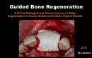 https://dental-books.com/wp-content/uploads/2023/04/Guided-Bone-Regeneration-a-30-year-Biological-2.jpg