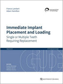 https://dentalmp4.com/wp-content/uploads/2023/11/Immediate-Implant-Placement-and-Loading.jpg