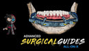 https://dentalmp4.com/wp-content/uploads/2023/04/Implant-Ninja-Advanced-Surgical-Guides-All-on-X.jpg