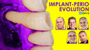 https://dentalmp4.com/wp-content/uploads/2025/03/Implant-Perio-Evolution-1.0.jpg